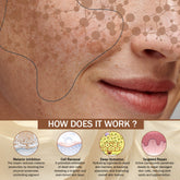 7Days Natural Pigmentation Cream for Acne Scar Removal Pigmentation, Dark Spots & face Glowing (100 g)